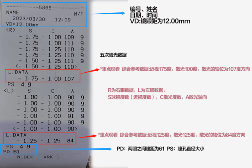 视力数据的含义。重庆普瑞眼科医院供图