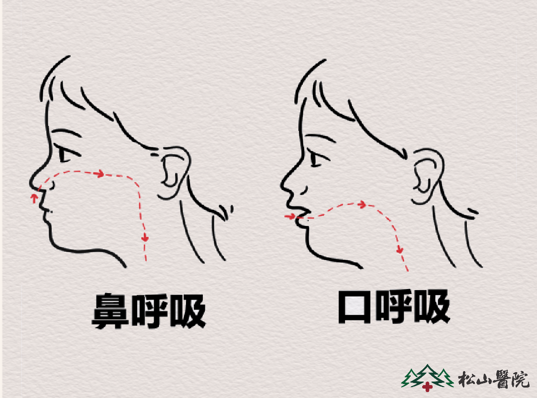 口呼吸和鼻呼吸的区别。重庆松山医院供图