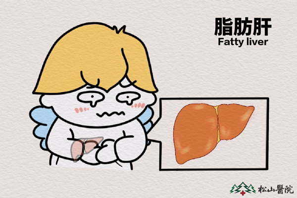 脂肪肝。重庆松山医院供图