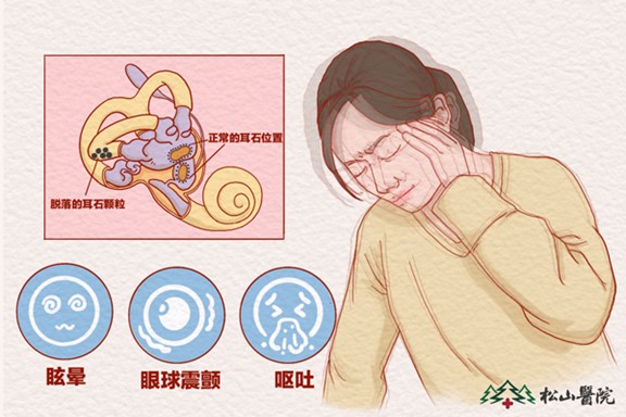 耳石症。重庆松山医院供图