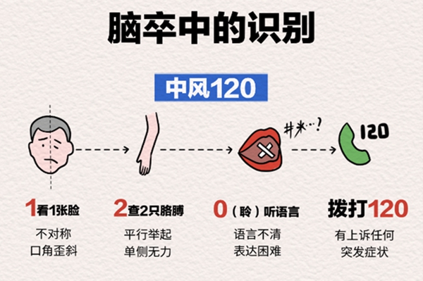 “中风120”口诀。重庆松山医院供图