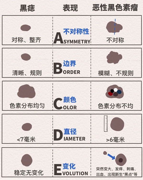 ABCDE法则示意图。重庆松山医院供图