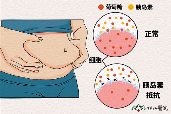 黑棘皮病的病因。重慶鬆山醫院供圖