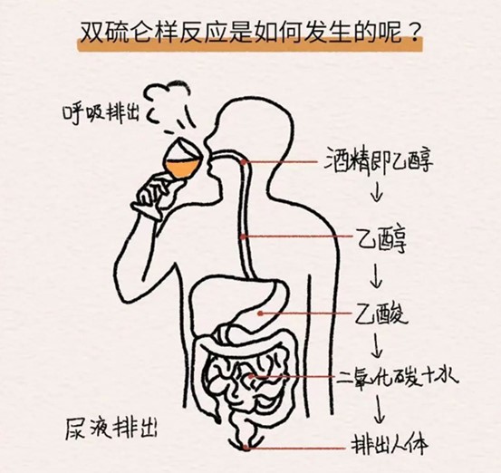 示意圖。重慶鬆山醫院供圖