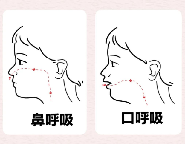 下巴后缩怎么办？重庆松山医院：口呼吸需尽早干预