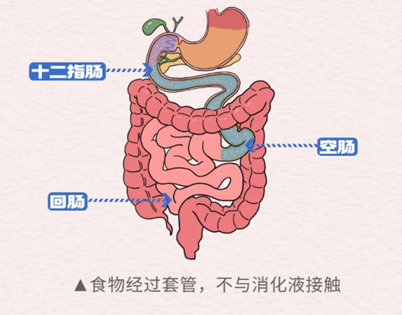 示意圖。重慶鬆山醫院供圖