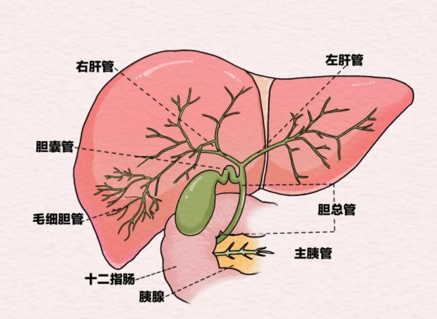 胆结石。重庆松山医院供图