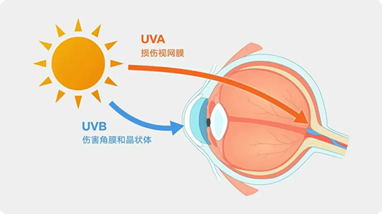紫外線對眼睛的傷害。重慶南坪愛爾眼科醫院供圖