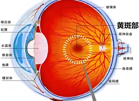 黃斑部。重慶普瑞眼科醫院供圖